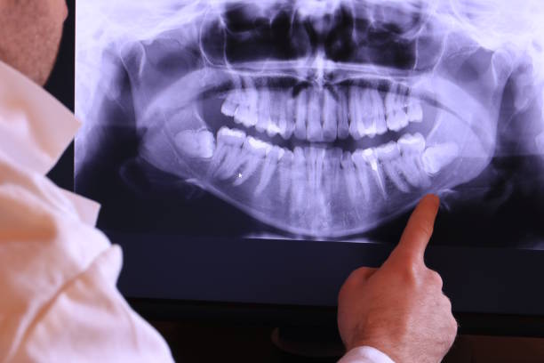 Best Emergency Dentist for Lost Fillings or Crowns in Day Heights, OH